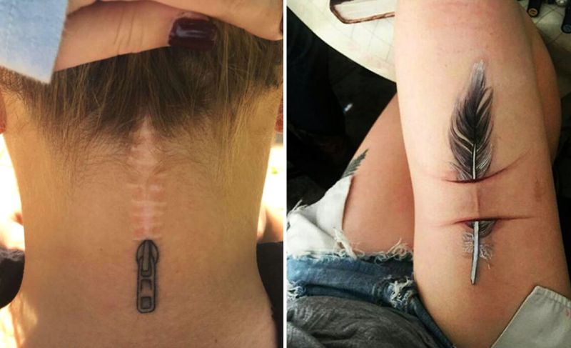 Clever tattoo designs that turn scars into beautiful works of art